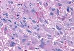 Glucagon Receptor Antibody in Immunohistochemistry (Paraffin) (IHC (P))