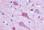 GPR1 Antibody in Immunohistochemistry (Paraffin) (IHC (P))