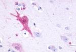 GPR110 Antibody in Immunohistochemistry (Paraffin) (IHC (P))