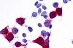 GPR137B Antibody in Immunocytochemistry (ICC/IF)