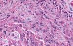 GPR137B Antibody in Immunohistochemistry (Paraffin) (IHC (P))
