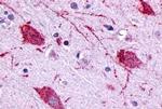 GPR146 Antibody in Immunohistochemistry (Paraffin) (IHC (P))