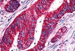 GPR15 Antibody in Immunohistochemistry (Paraffin) (IHC (P))