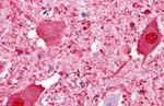 GPR151 Antibody in Immunohistochemistry (Paraffin) (IHC (P))