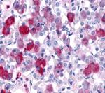 GPR161 Antibody in Immunohistochemistry (Paraffin) (IHC (P))