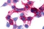 GPR17 Antibody in Immunocytochemistry (ICC/IF)