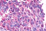 GPR17 Antibody in Immunohistochemistry (Paraffin) (IHC (P))