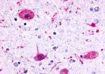 GPR17 Antibody in Immunohistochemistry (Paraffin) (IHC (P))