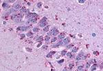 GPR31 Antibody in Immunohistochemistry (Paraffin) (IHC (P))