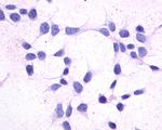 CRTH2 Polyclonal Antibody