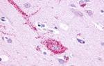 GPR61 Antibody in Immunohistochemistry (Paraffin) (IHC (P))