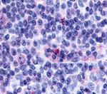 GPR65 Antibody in Immunohistochemistry (Paraffin) (IHC (P))