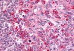 GPR65 Antibody in Immunohistochemistry (Paraffin) (IHC (P))