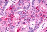 GPR81 Antibody in Immunohistochemistry (Paraffin) (IHC (P))