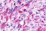 GPR81 Antibody in Immunohistochemistry (Paraffin) (IHC (P))