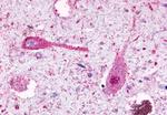 GPR81 Antibody in Immunohistochemistry (Paraffin) (IHC (P))