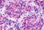 GPR81 Antibody in Immunohistochemistry (Paraffin) (IHC (P))