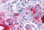 GPR82 Antibody in Immunohistochemistry (Paraffin) (IHC (P))