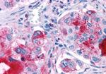 GPR82 Antibody in Immunohistochemistry (Paraffin) (IHC (P))