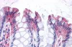 GPR82 Antibody in Immunohistochemistry (Paraffin) (IHC (P))