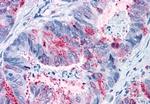 GPR82 Antibody in Immunohistochemistry (Paraffin) (IHC (P))