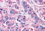 GPR82 Antibody in Immunohistochemistry (Paraffin) (IHC (P))