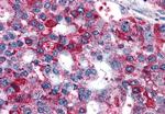 GPR82 Antibody in Immunohistochemistry (Paraffin) (IHC (P))
