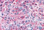GPR82 Antibody in Immunohistochemistry (Paraffin) (IHC (P))