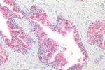GPR87 Antibody in Immunohistochemistry (Paraffin) (IHC (P))
