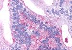 GPR88 Antibody in Immunohistochemistry (Paraffin) (IHC (P))