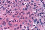 GPRC5C Antibody in Immunohistochemistry (Paraffin) (IHC (P))