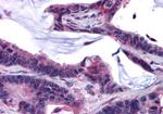 GPRC5C Antibody in Immunohistochemistry (Paraffin) (IHC (P))