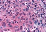 GPRC5C Antibody in Immunohistochemistry (Paraffin) (IHC (P))