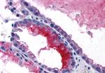 GPRC5C Antibody in Immunohistochemistry (Paraffin) (IHC (P))