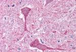 mGluR3 Antibody in Immunohistochemistry (Paraffin) (IHC (P))