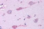 mGluR3 Antibody in Immunohistochemistry (Paraffin) (IHC (P))