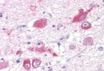 mGluR5 Antibody in Immunohistochemistry (Paraffin) (IHC (P))
