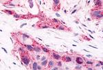 HNF4G Antibody in Immunohistochemistry (Paraffin) (IHC (P))