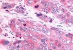 HUNK Antibody in Immunohistochemistry (Paraffin) (IHC (P))