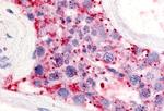 LPAR5 Polyclonal Antibody