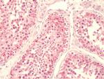 LPAR5 Polyclonal Antibody