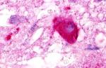 LPAR5 Antibody in Immunohistochemistry (Paraffin) (IHC (P))