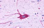 LPAR6 Antibody in Immunohistochemistry (Paraffin) (IHC (P))