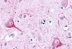 LPHN2 Antibody in Immunohistochemistry (Paraffin) (IHC (P))