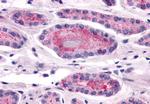 LPHN2 Antibody in Immunohistochemistry (Paraffin) (IHC (P))