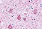 LPHN2 Antibody in Immunohistochemistry (Paraffin) (IHC (P))