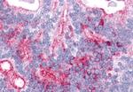 LPHN2 Antibody in Immunohistochemistry (Paraffin) (IHC (P))