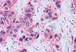 MAS1 Antibody in Immunohistochemistry (Paraffin) (IHC (P))