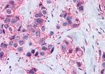 MAS1 Antibody in Immunohistochemistry (Paraffin) (IHC (P))