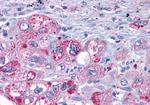 MAS1 Antibody in Immunohistochemistry (Paraffin) (IHC (P))